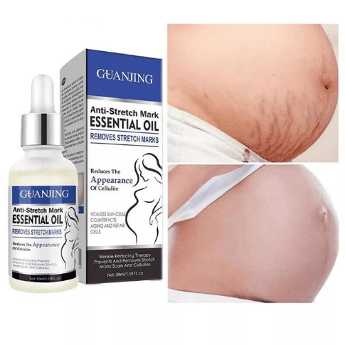 Anti-Stretch Marks Essential Oil