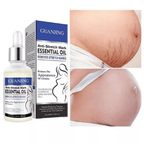 Anti-Stretch Marks Essential Oil